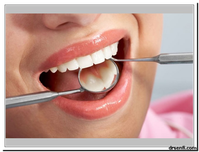 عوارض کامپوزیت دندان در کلینیک دکتر صنفی