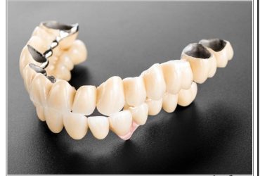 قیمت پروتز دندان در کلینیک دندانپزشکی دکتر صنفی